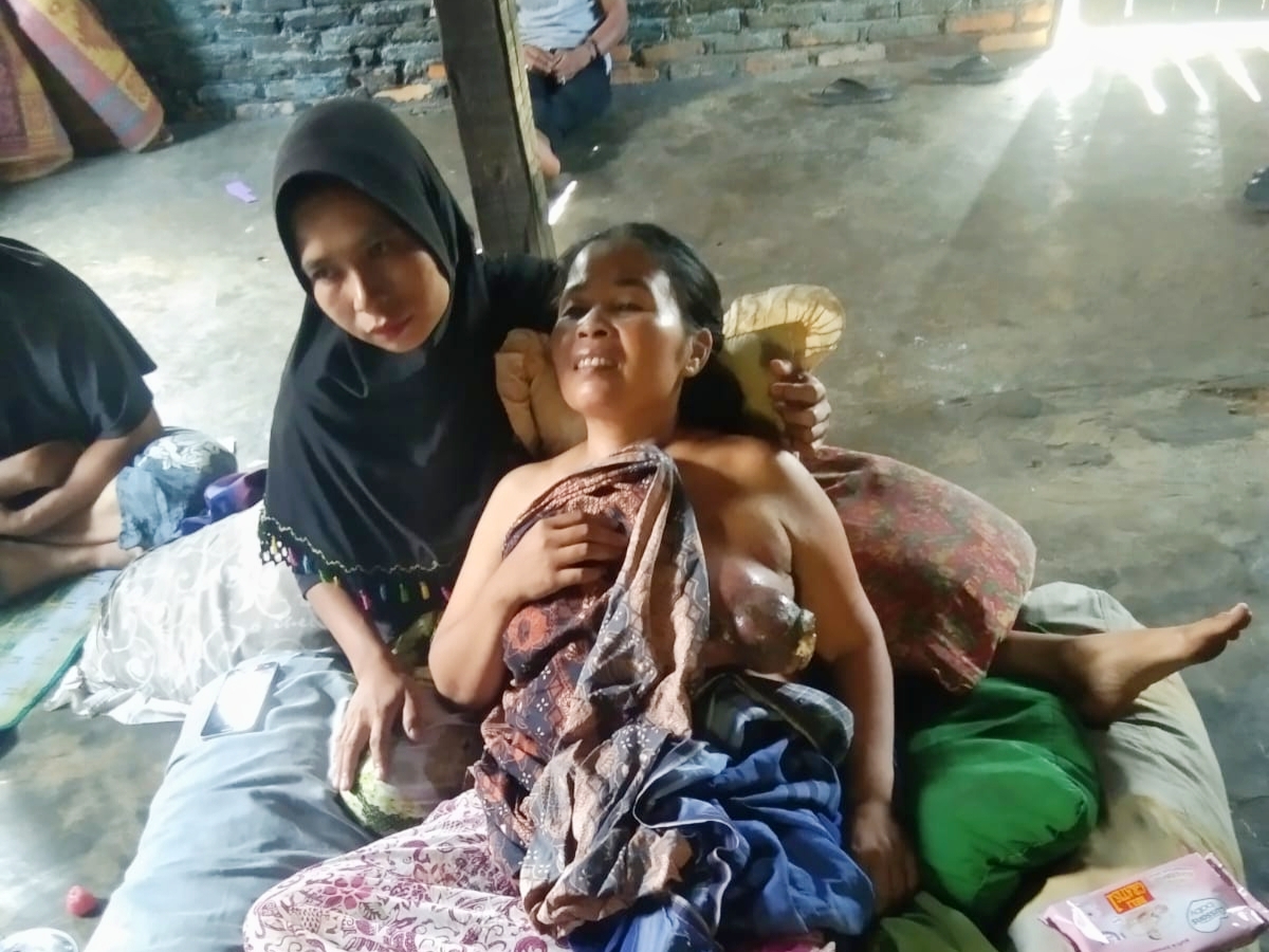 Harmaini (39) ibu tiga anak buruh tani Warga Desa Malintang mengidap penyakit kanker ini hanya bisa terbaring lemas diatas kasur kapuk yang tampak lusuh. fhoto : Istimewa.