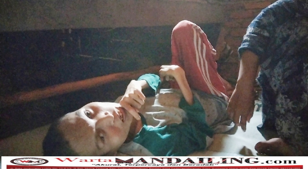 Seorang pemuda berusia 29 tahun asal Kelurahan kayu jati, Kecamatan Panyabungan, Kabupaten Mandailing Natal, menderita lumpuh sejak tujuh tahun lalu. fhoto : Minggu (11/6/2023) Warta Mandailing.