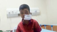 Nasaruddin bocah miskin berusia (11) penderita benjolan di wajah asal Desa Tanjung Jae, Kecamatan Panyabungan Timur, Kabupaten Mandailing Natal telah selesai menjalani operasi pengangkatan benjolan, Jumat (22/9/2023) fhoto : istimewa.