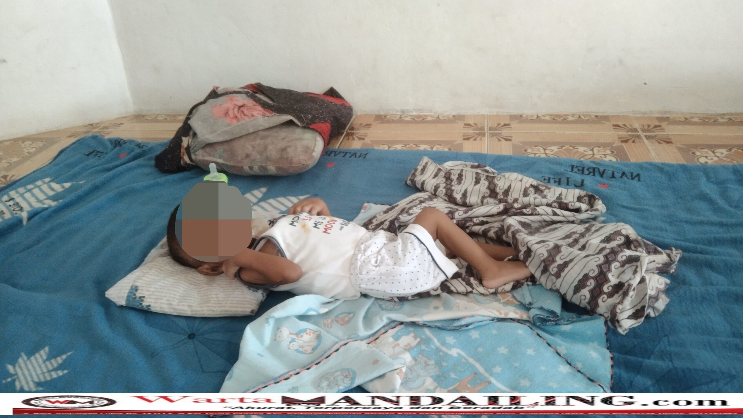 Muhammad Erkhan bayi penderita gizi buruk asal Sipolu-polu meninggal dunia, Rabu (4/10/2023) fhoto : Wartamandailing.