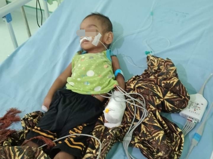 Riski Maulana (2) seorang anak penderita gizi buruk, TB paru dan stunting, warga Mandailing Natal, kondisinya kini sangat memprihatinkan. Rabu (28/5/2024) fhoto : Istimewa.